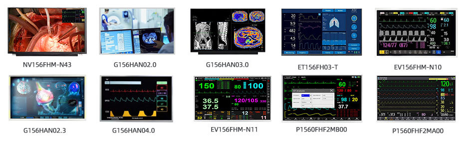 P1560FHF2MA00 15.6 Inch TFT LCD Display 1920×1080 LVDS High Brightness Wide Temperature LCD Display For Healthcare Medical Display Solution
