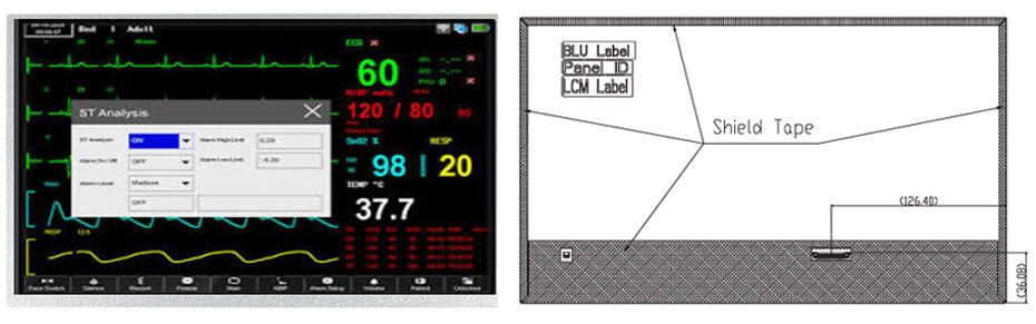 P1560FHF2MB00 15.6 Inch TFT LCD Display 1920×1080 LVDS LCD Display For Healthcare Medical Display Solution