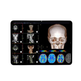 PPC100HB1-1 12.1 Inch TFT LCD Display 3000×2120 MIPI High Brightness LCD Display With In-Cell Touch For Healthcare Medical Display Solution. 