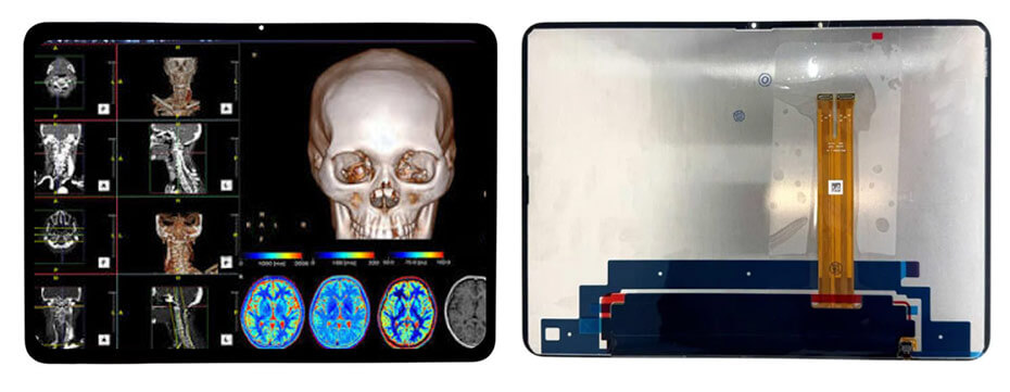 PPC100HB1-1 12.1 Inch TFT LCD Display 3000×2120 MIPI High Brightness LCD Display With In-Cell Touch For Healthcare Medical Display Solution