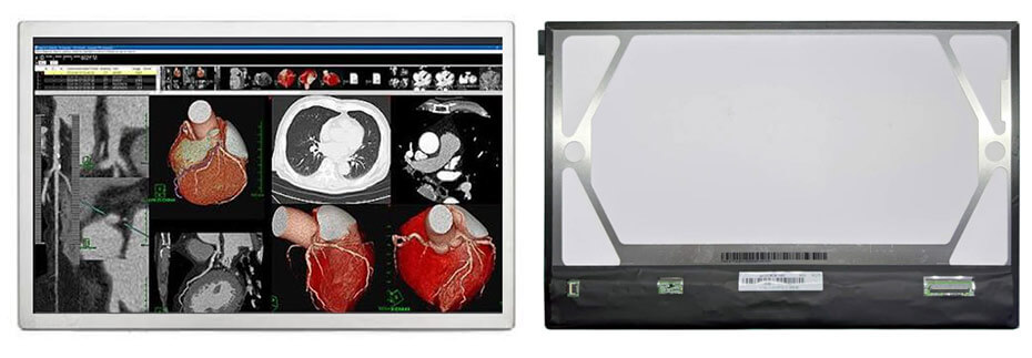 QV101WUM-N80 10.1 Inch TFT LCD Display 1920×1200 LVDS LCD Display For Healthcare Medical Display Solution
