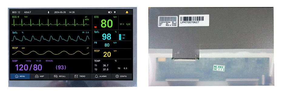 TX18D204VM0BAA 7 Inch TFT LCD Display 1920×1080 LVDS 600nits High Brightness LCD Display For Healthcare Medical Display Solution